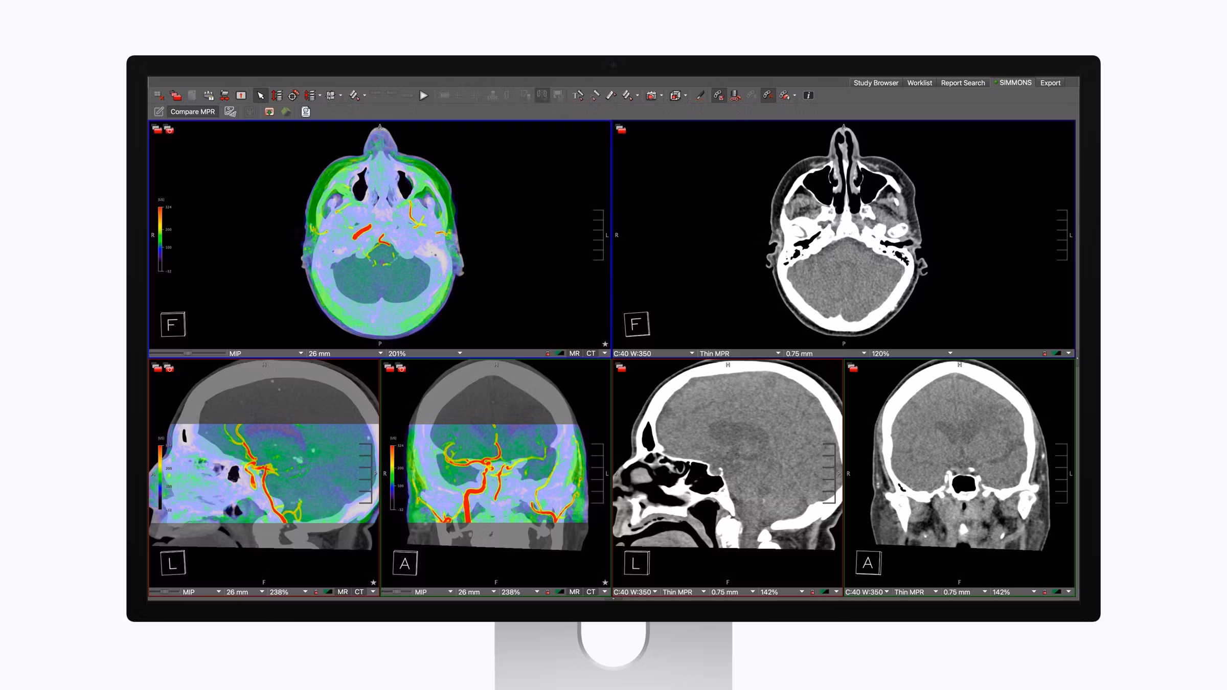 Apple Studio Display XDR ile Görsel Deneyiminizi Zirveye Taşıyın